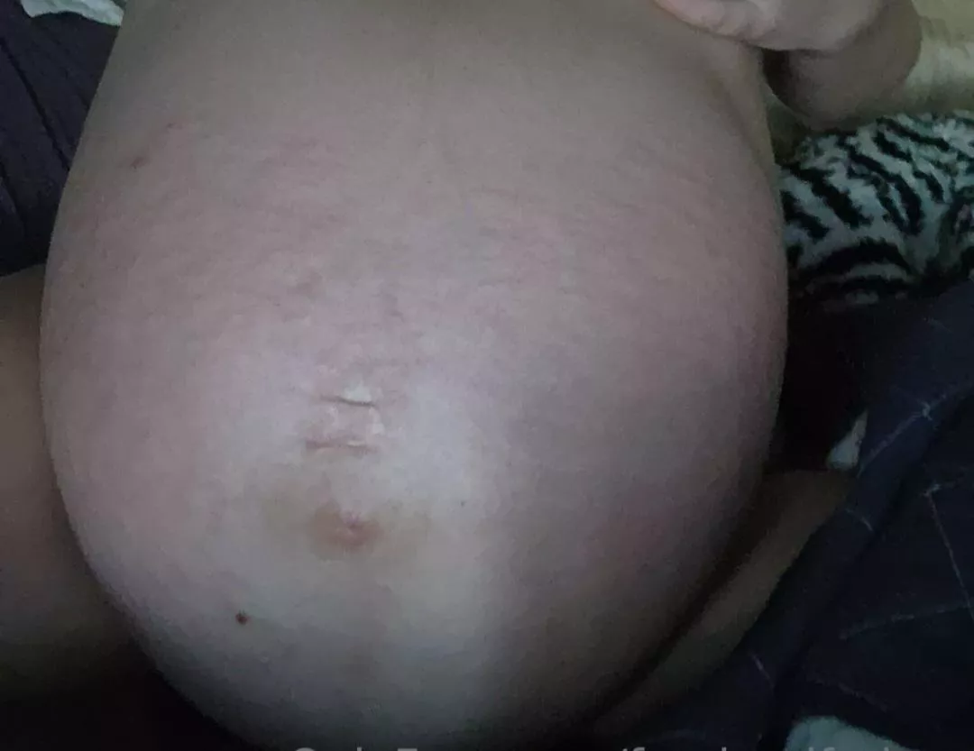 Twins are about to pop!