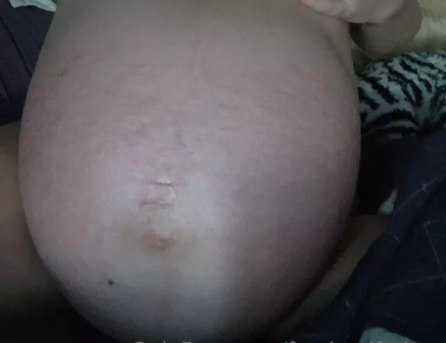 Twins are about to pop!