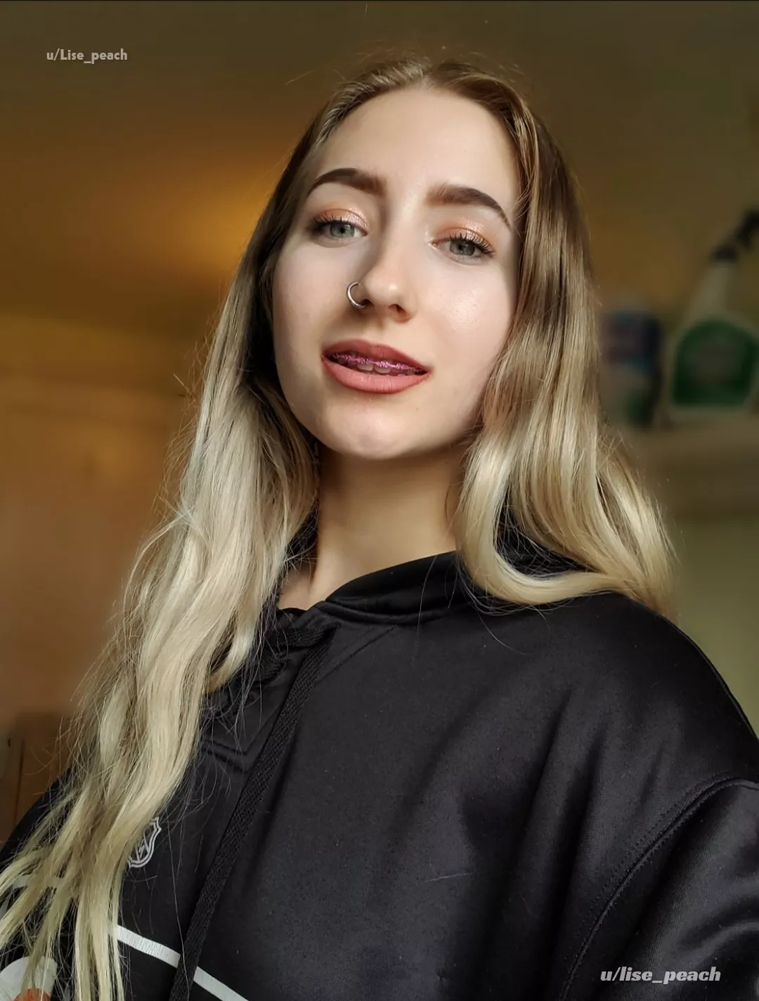 what's your preferred braces color