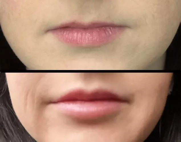 Wife just upgraded her lips. How do they look?