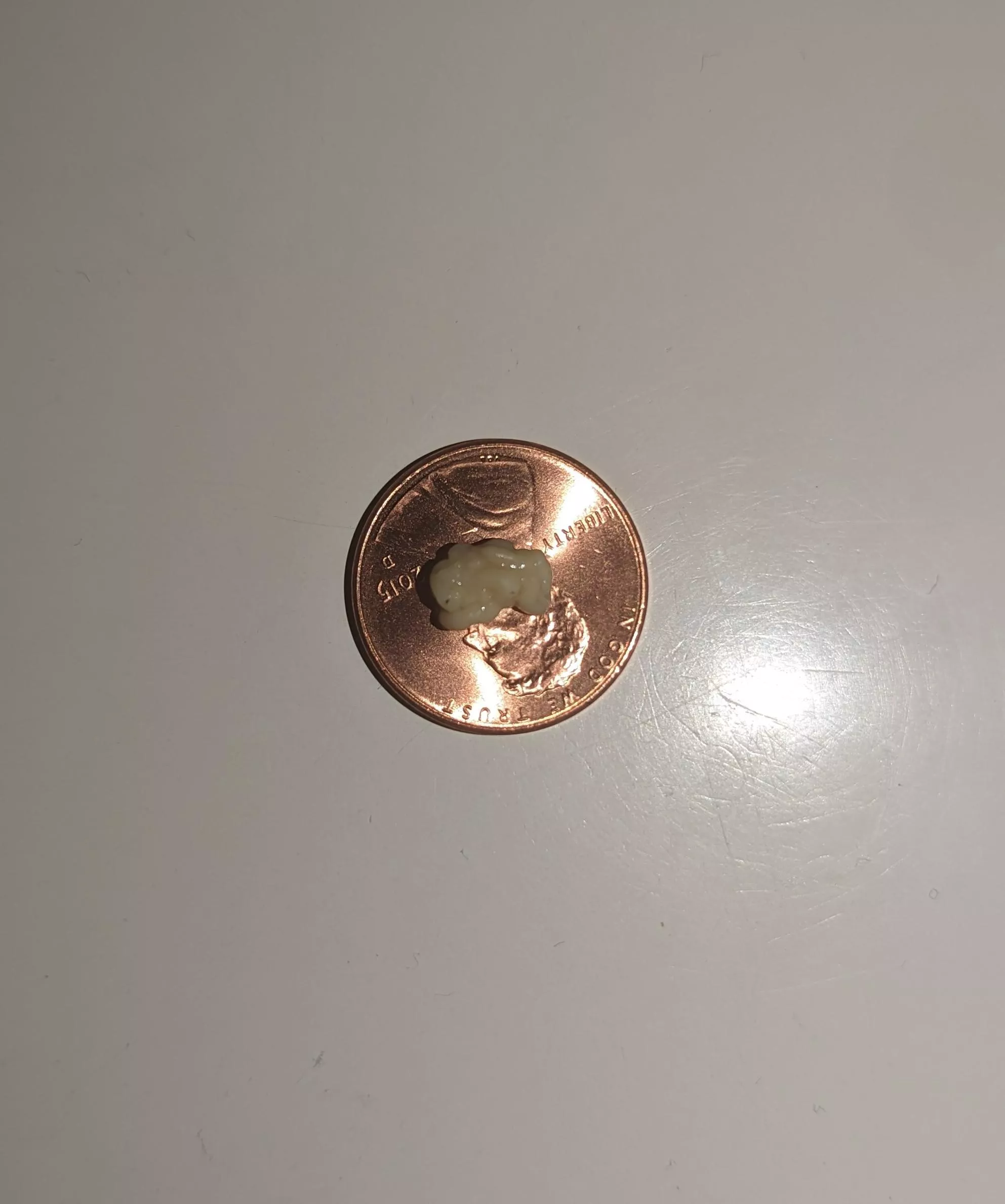 four score and 7 minutes ago I coughed out this tonsil stone