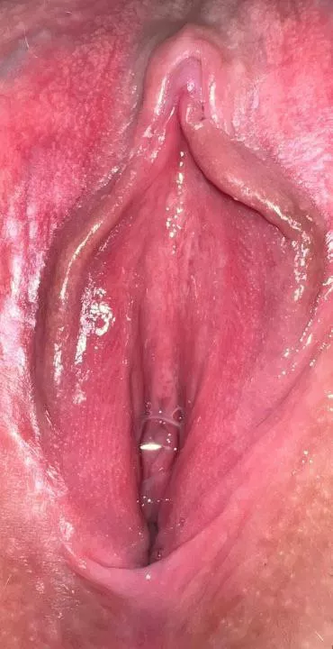 Extreme close up of my ovulation nectar today. My pussy drips nonstop while ovulating. Care to taste and then creampie? (F23)