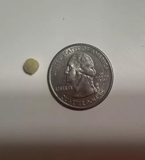 GIANT tonsil stone I found tonight wasn’t expecting it or I would have filmed