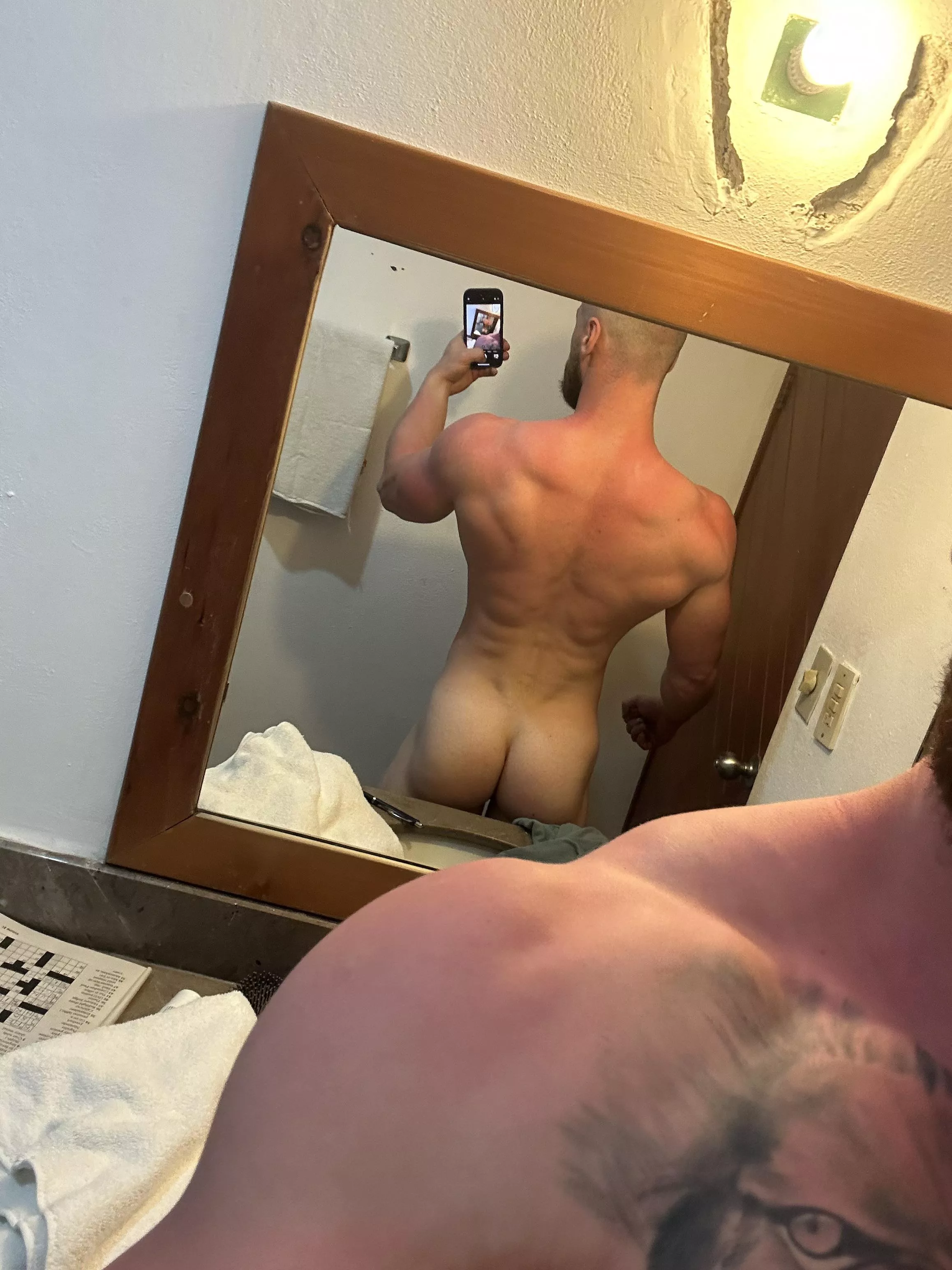 Got a little bit burnt yesterday. Anyone wanna run some lotion on me?