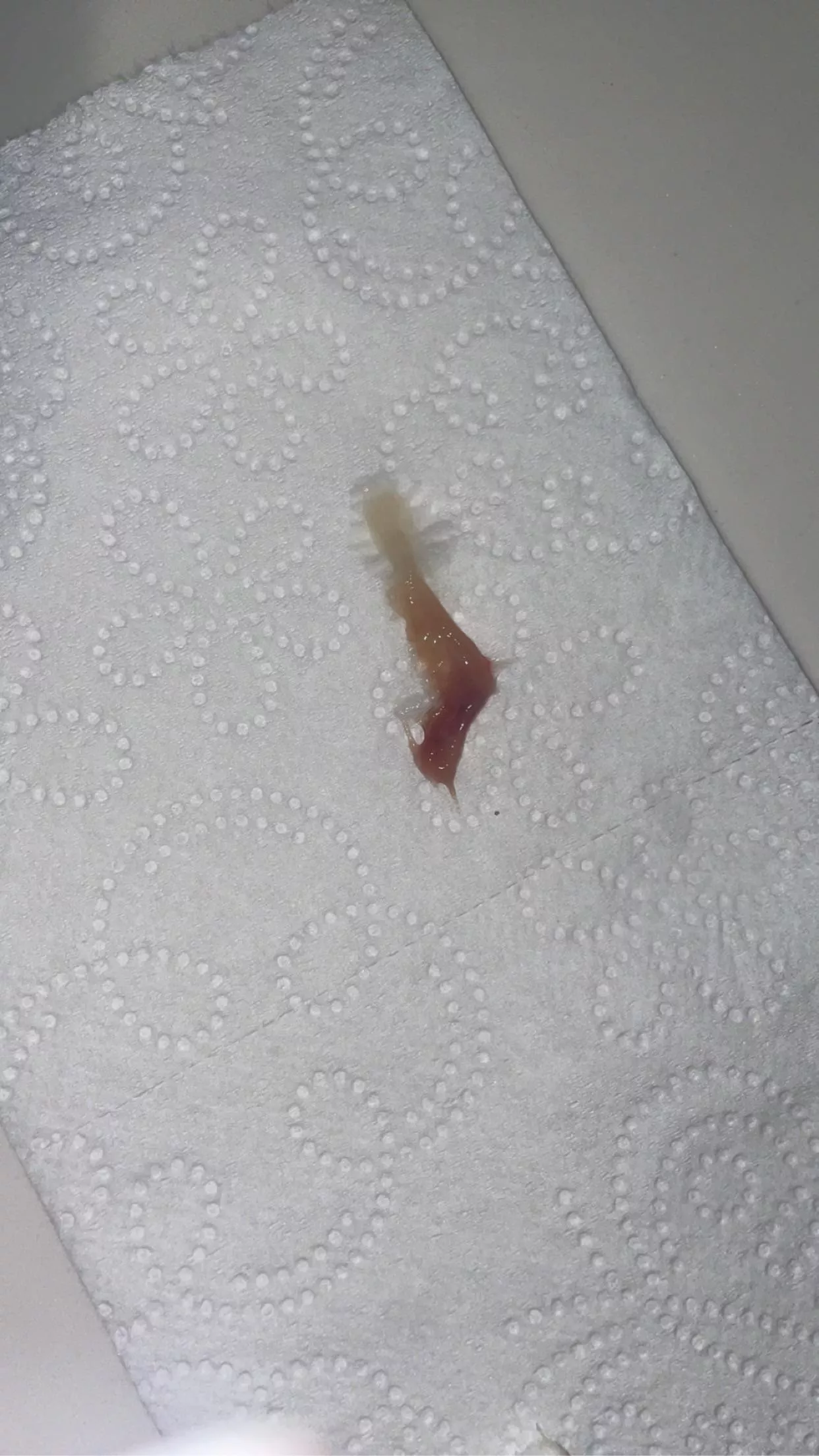 I'm sick, and felt something in my throat, so I pulled this thing out! I felt so much better afterwards. It's the size of a large paper clip irl. ***it's a clump of mucous from my sinuses that drained into my throat! NSFW because i think there is bloo I'm sick, and felt something in my throat, so I pulled this thing out! I felt so much better afterwards. It's the size of a large paper clip irl. ***it's a clump of mucous from my sinuses that drained into my throat! NSFW because i think there is bloo