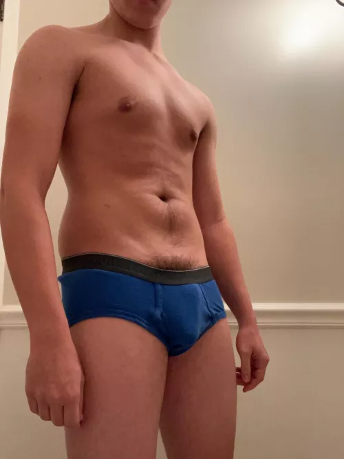 Soft bulge