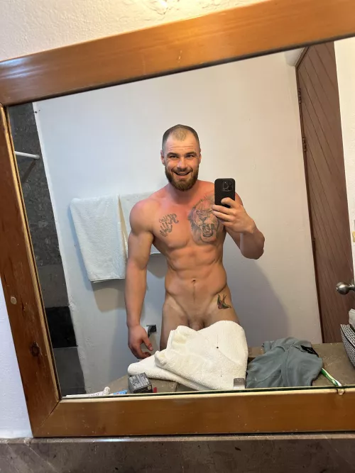 Who has lotion for this burn?😉😈