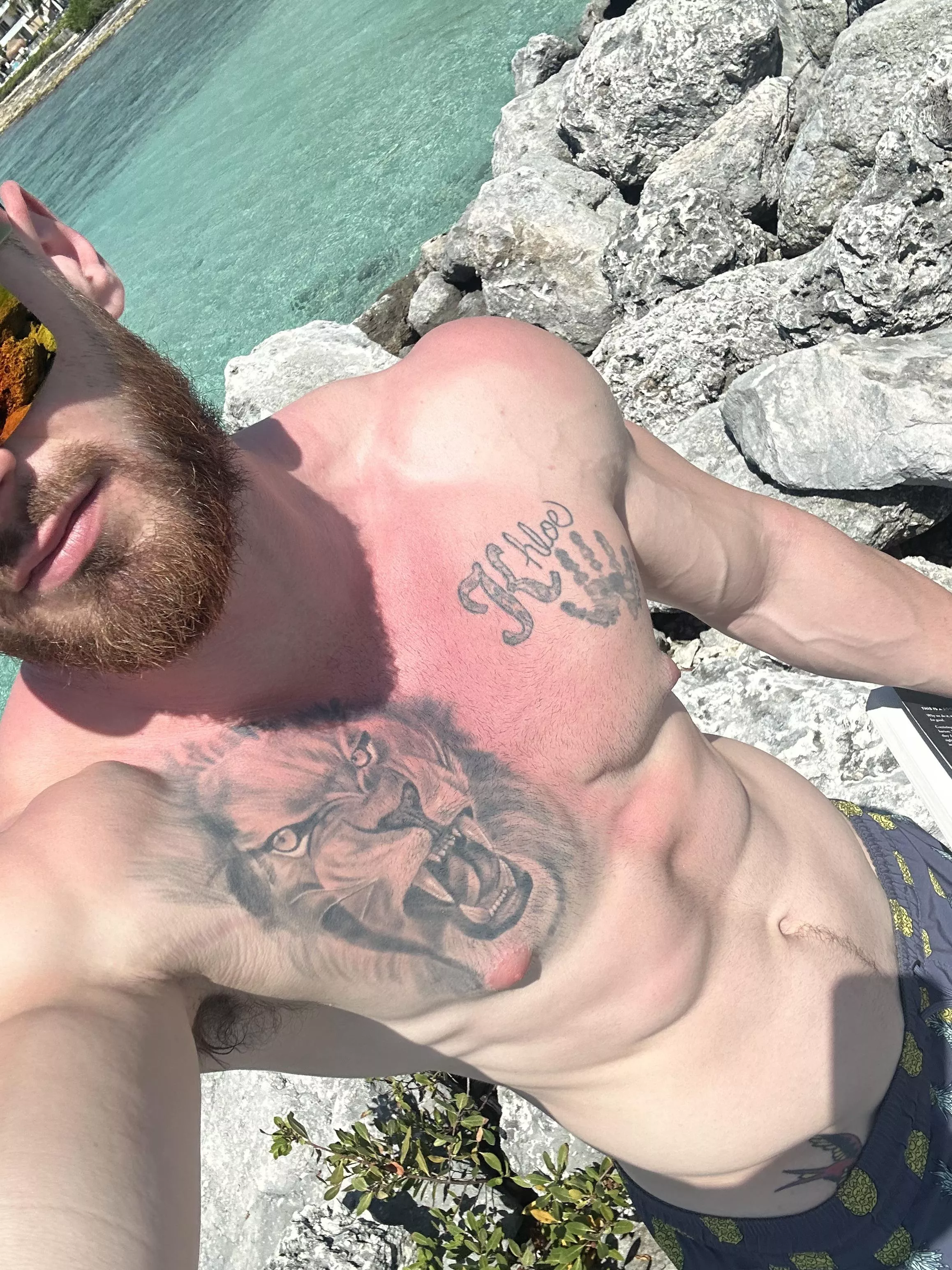 Hope this turns into a nice tan 😅