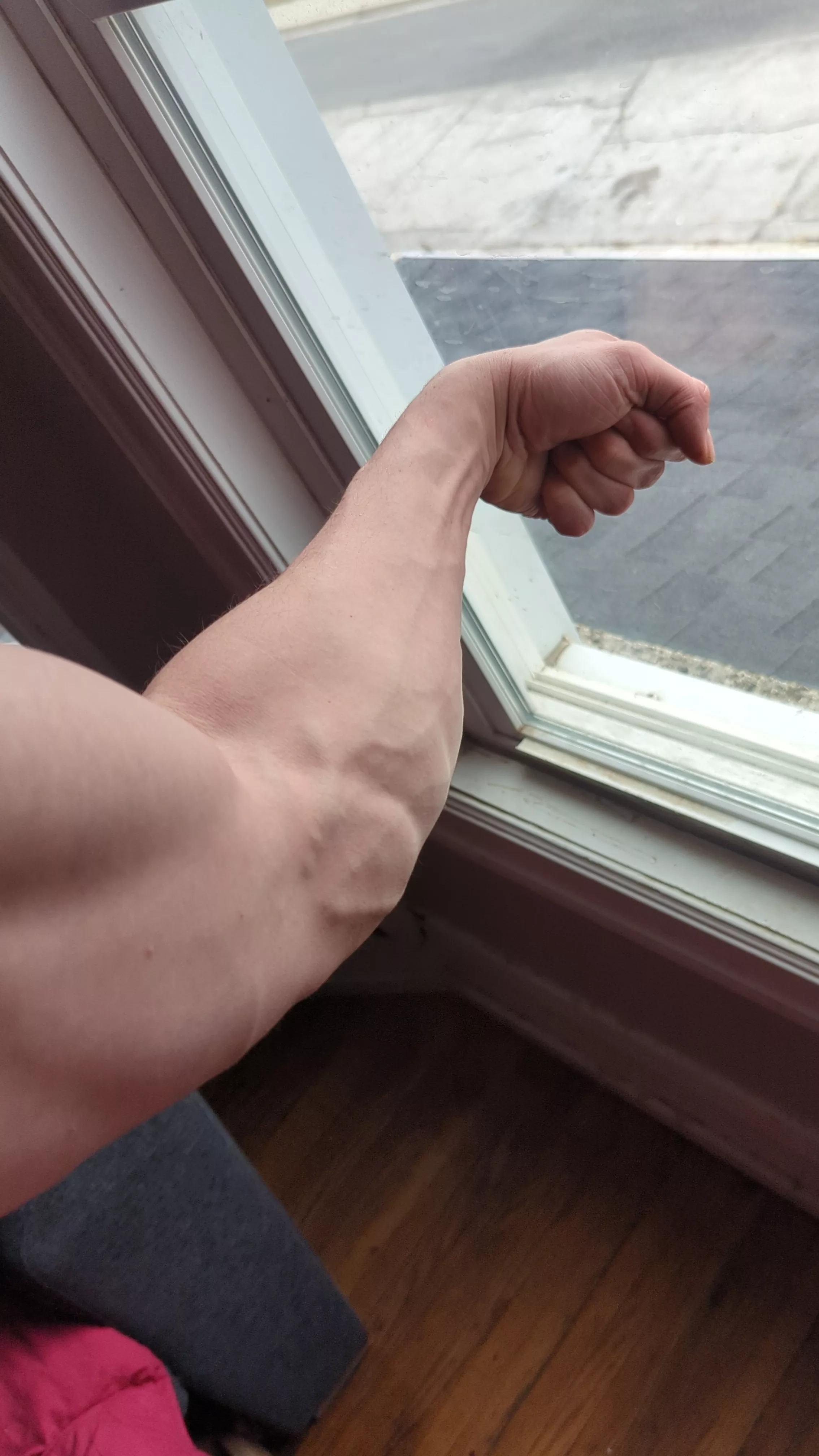 leg or arm?