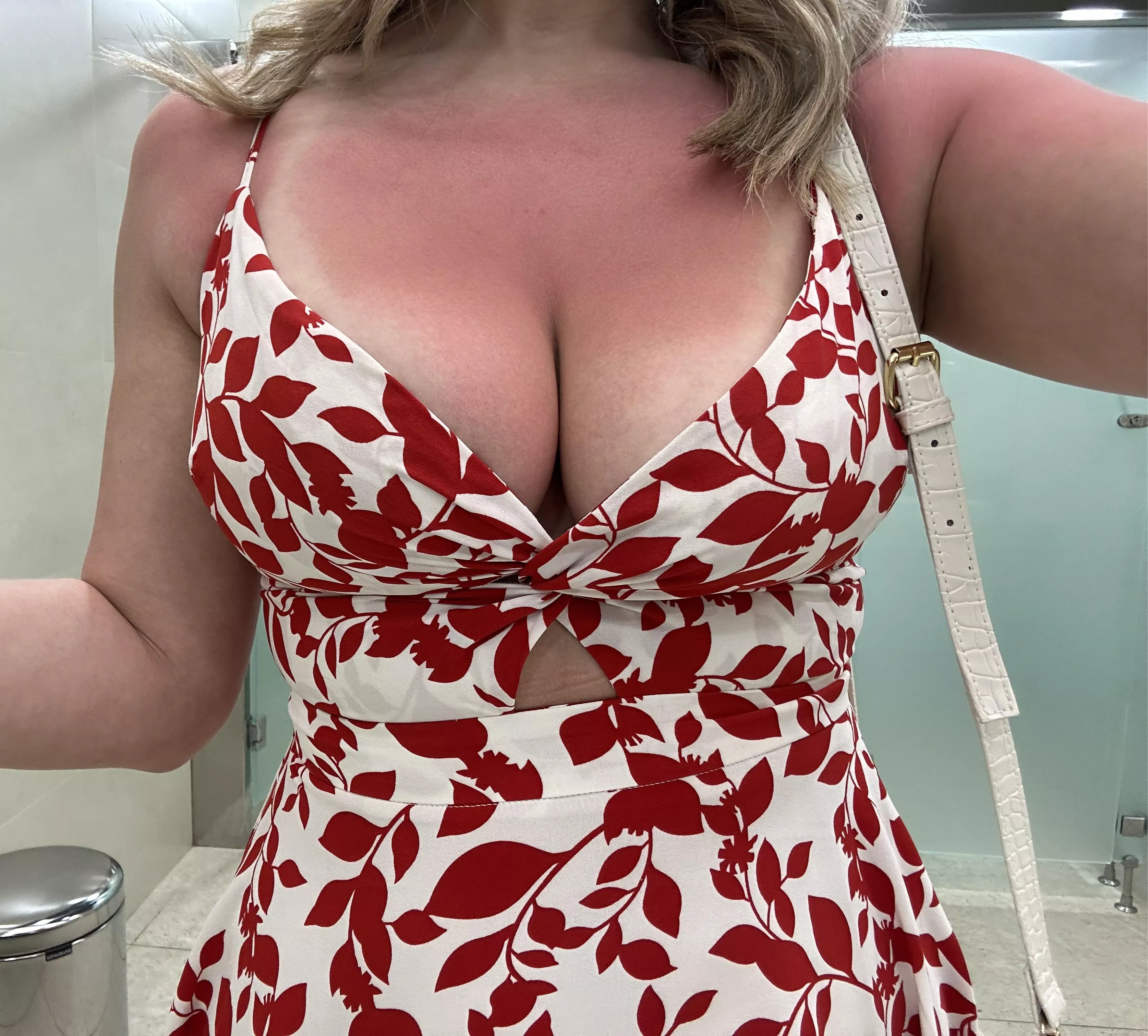 Braless.. and sunburnt 😭