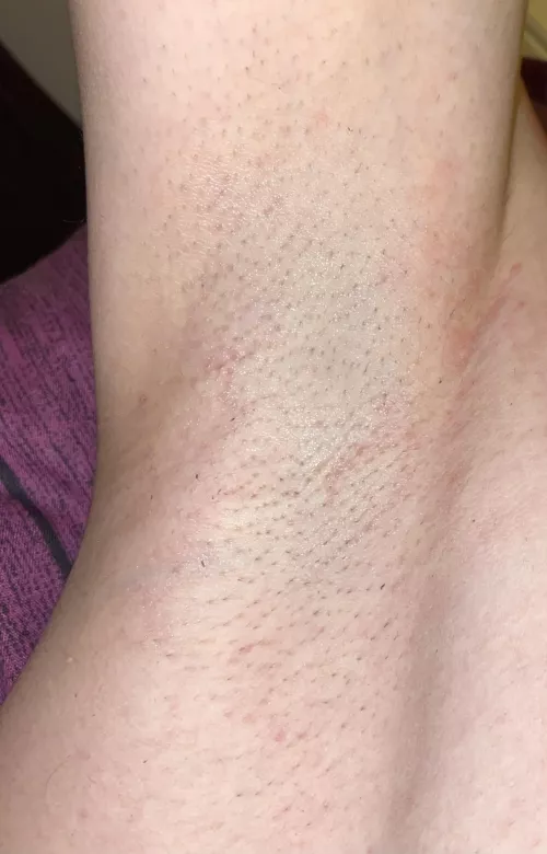 First time posting here pls be nice ☺️🥰😋