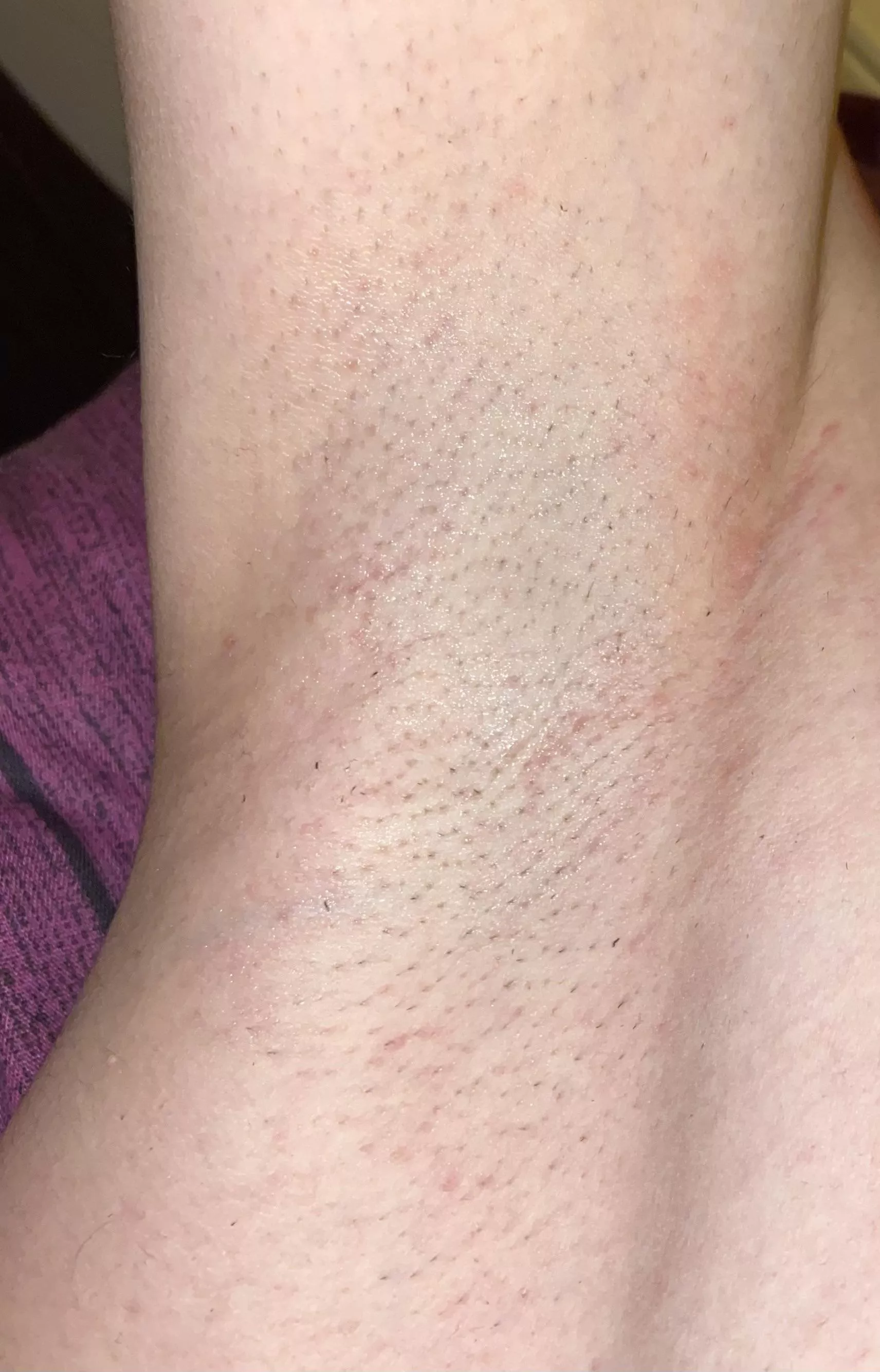 First time posting here pls be nice ☺️🥰😋