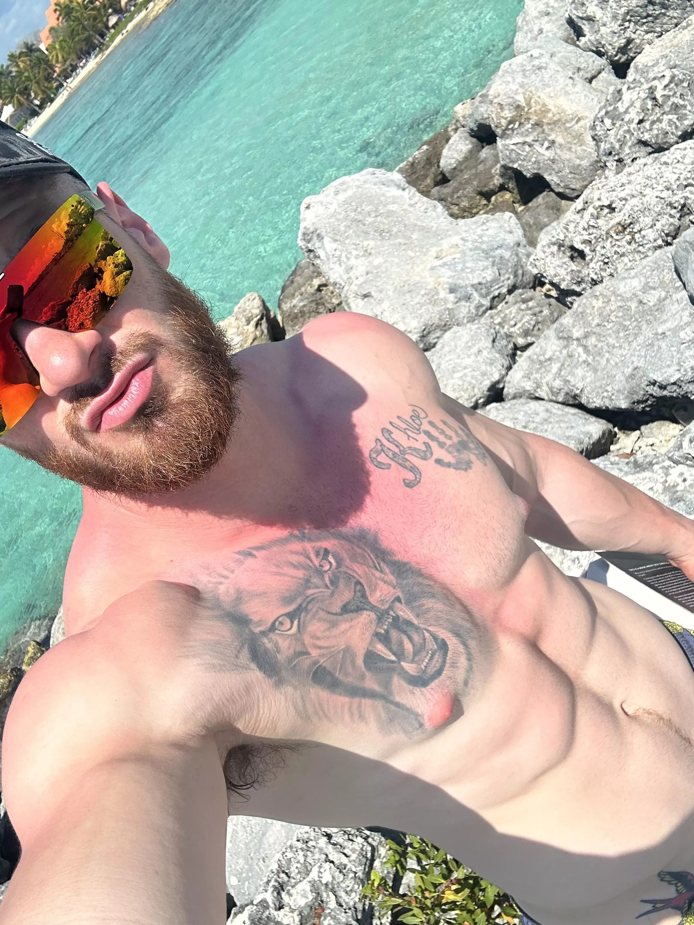 Hope this turns into a nice tan 😅