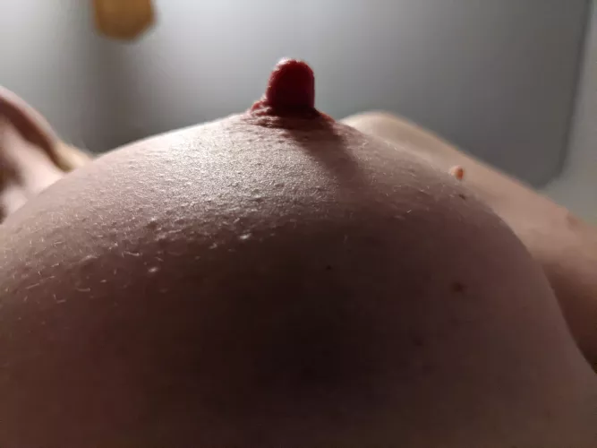 It wants some attention.