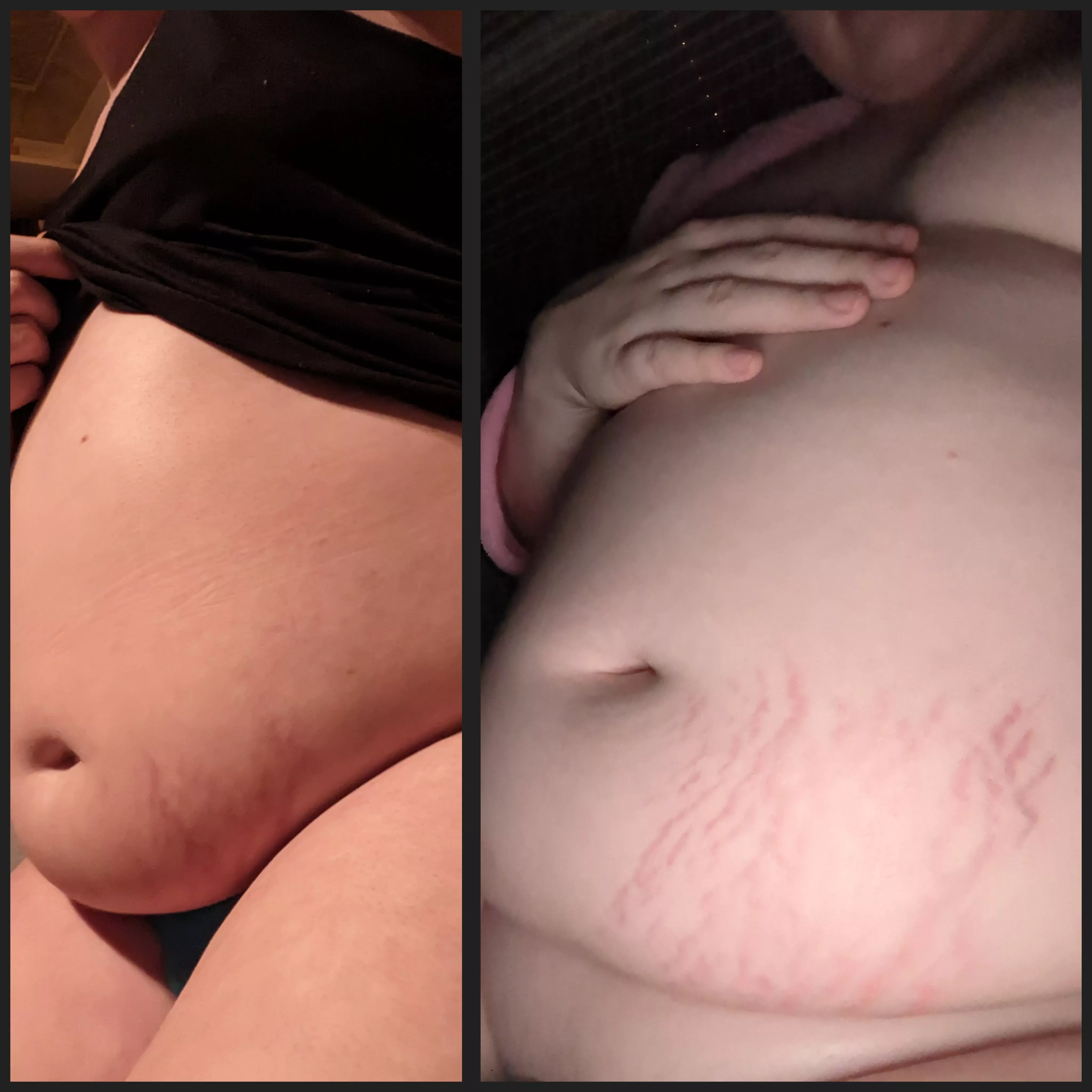 Look at That Stretch Mark Growth! 11th January 2023- Today
