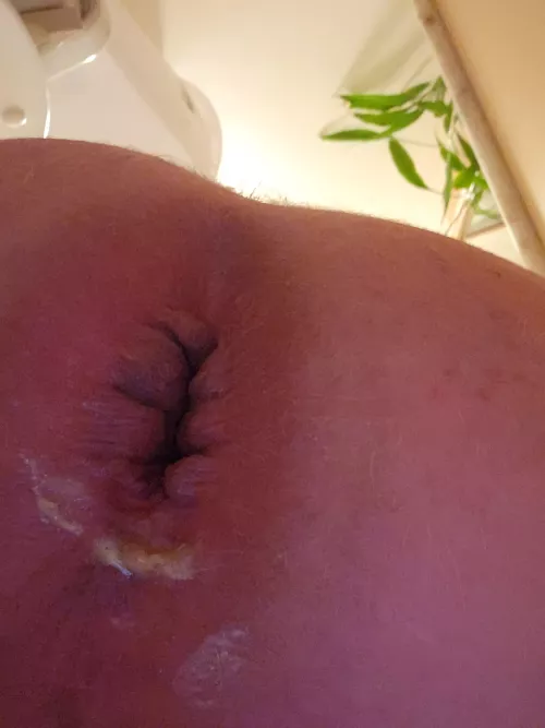 my gape after a nice fist