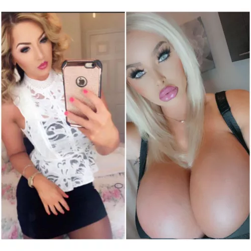 Amazing what fake tits and lips can do🤤