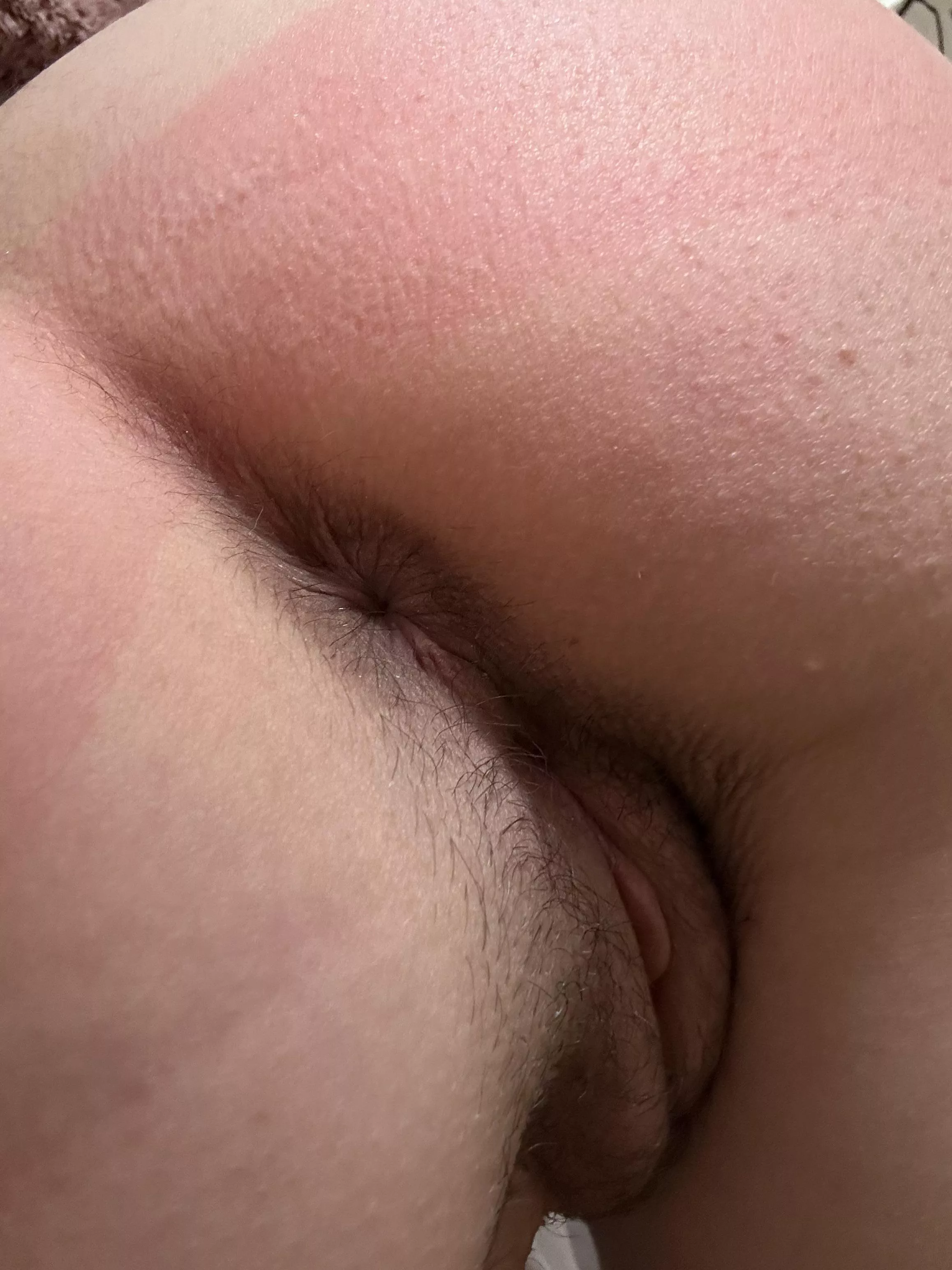 I don’t what happened but my asshole is changing shape :(((