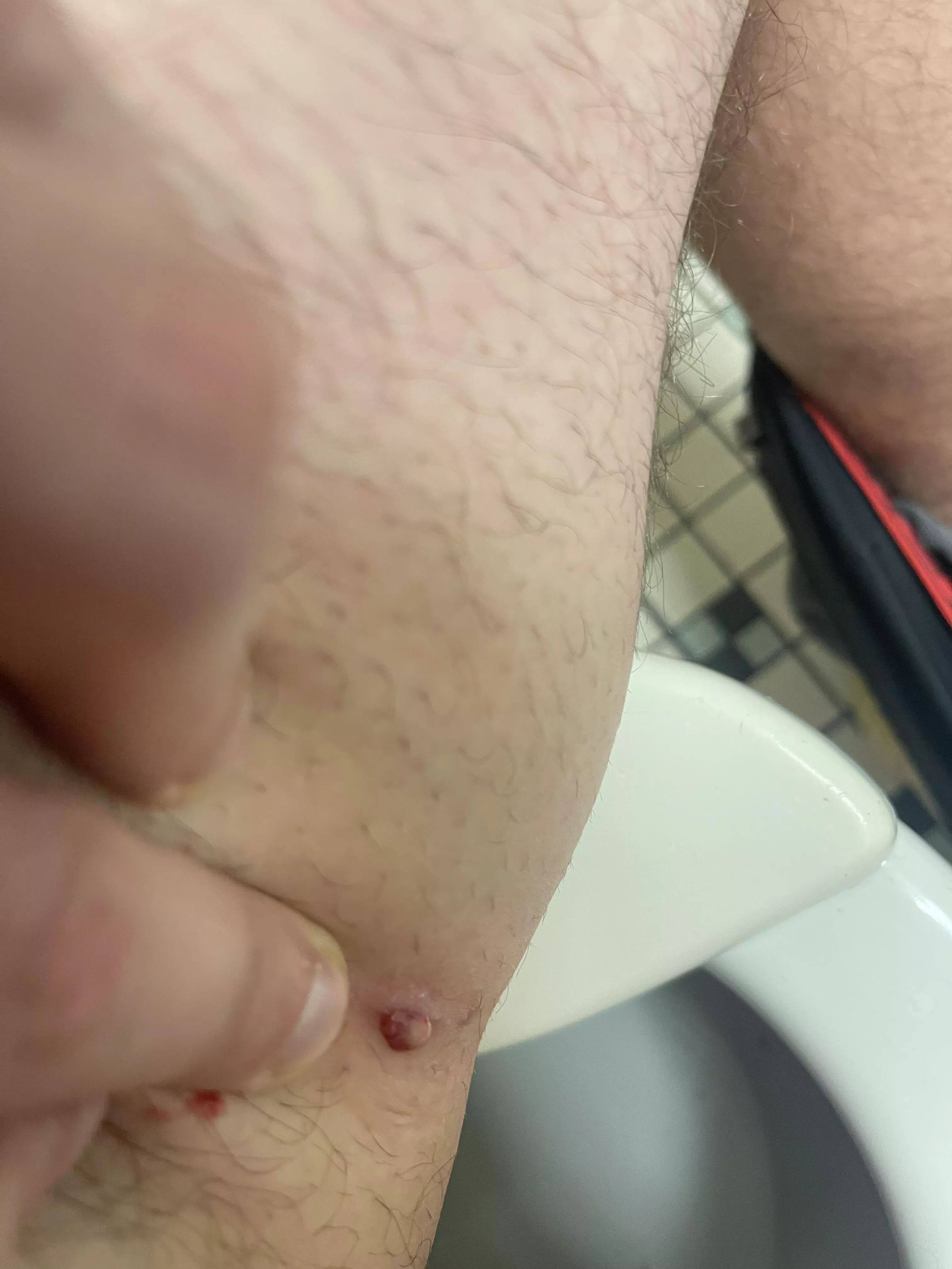 Last update i think its finally done it made a small audible pop