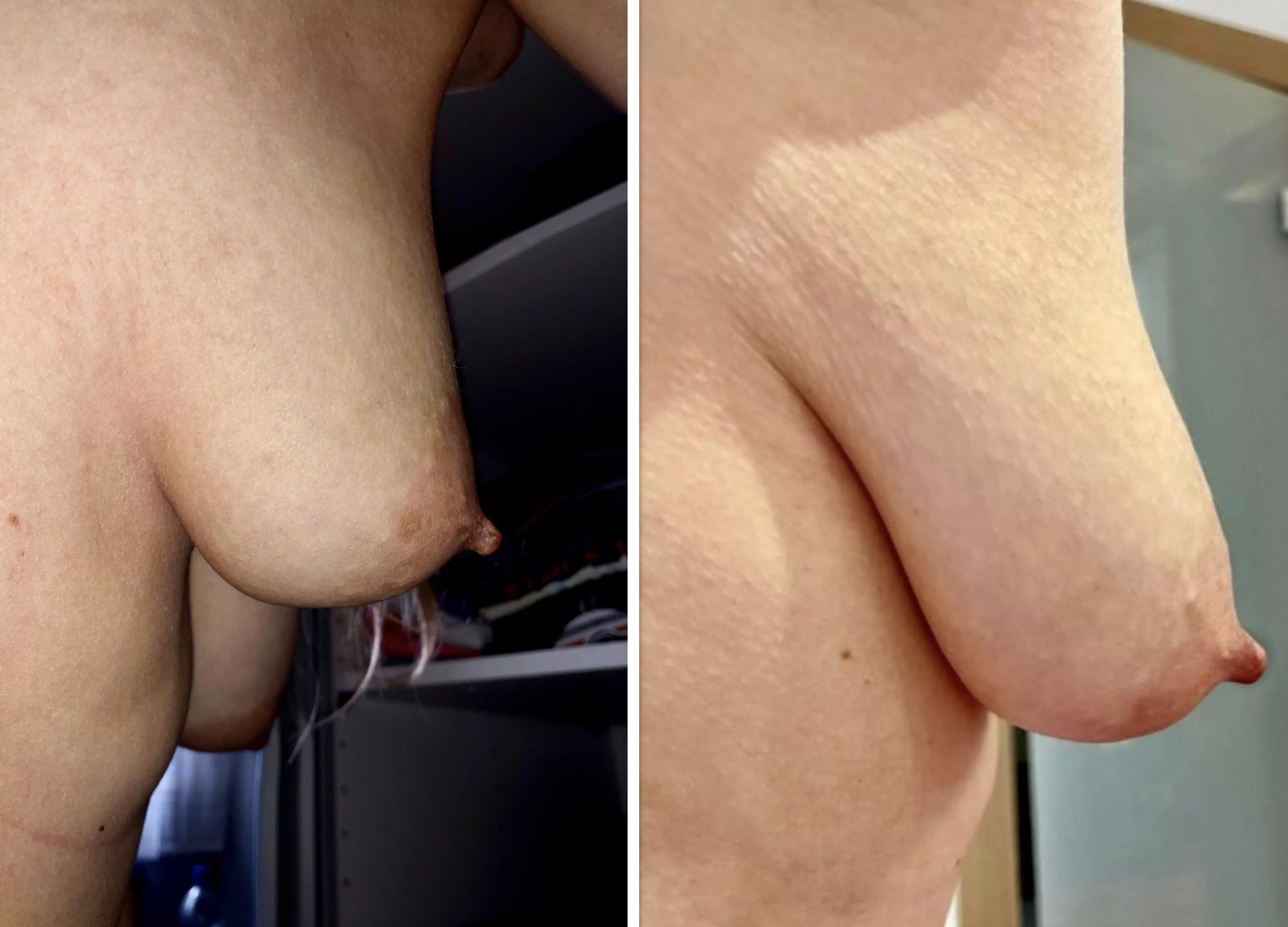 My transformation (F28&F34)