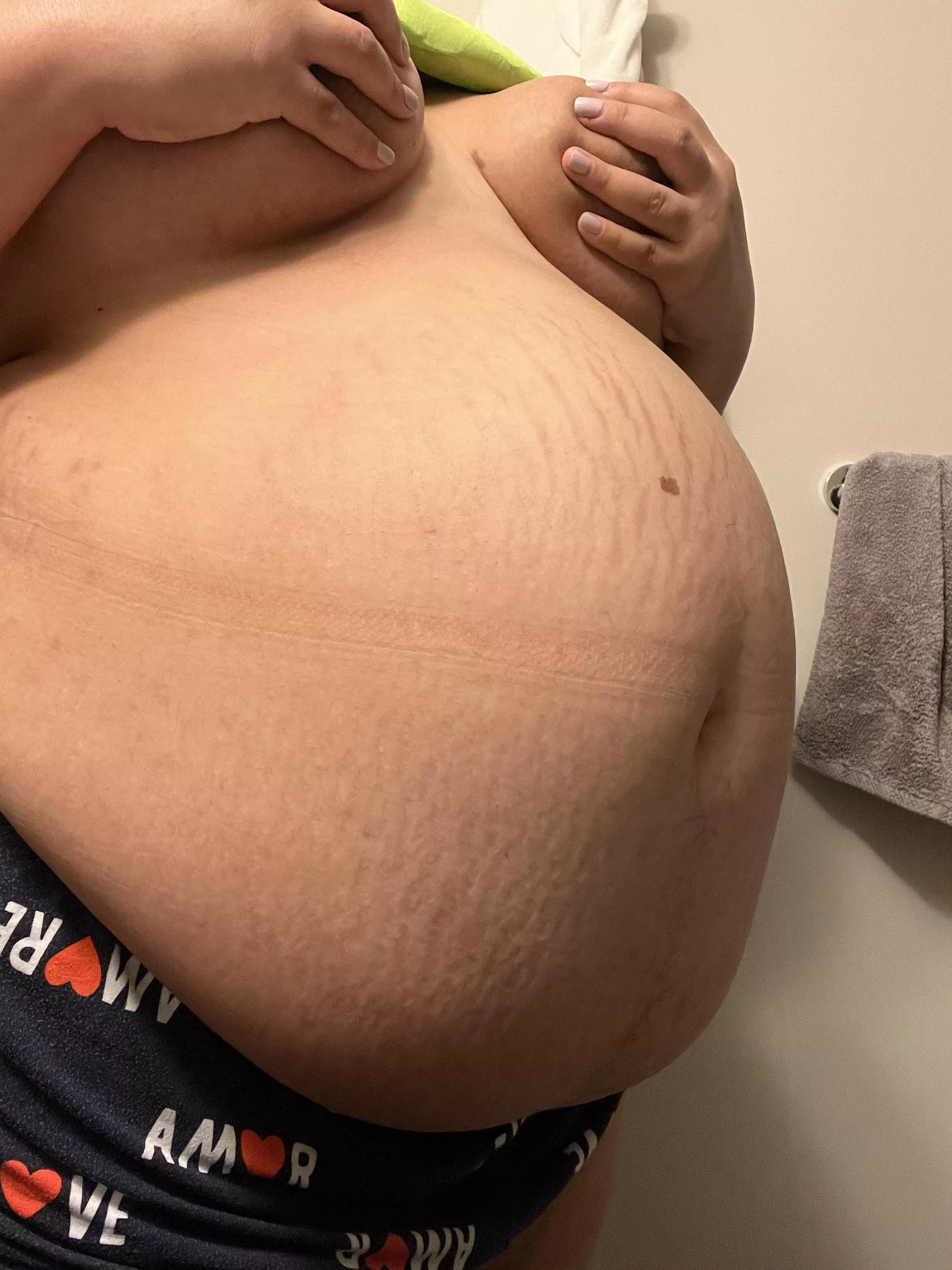 The stretch marks prove how stretched out I am 😂