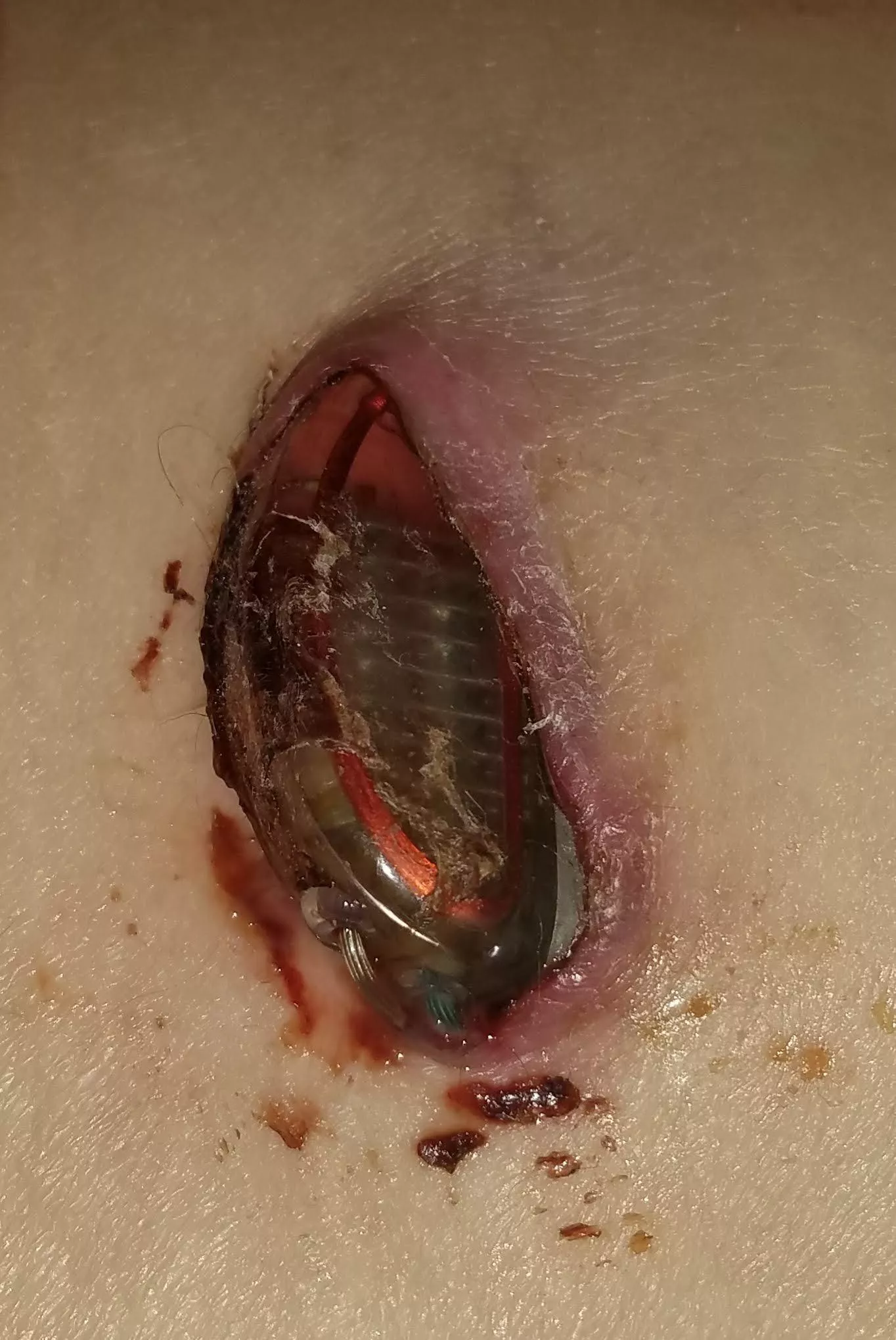 Wednesday Forbidden Pop Medical Implant