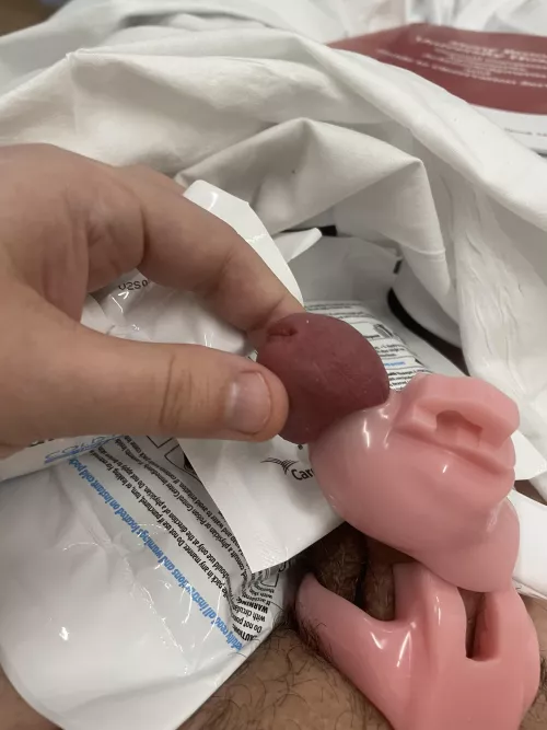 Any tips for the docs in the ER? I’m totally serious unfortunately. Its a Holy Trainer Nub