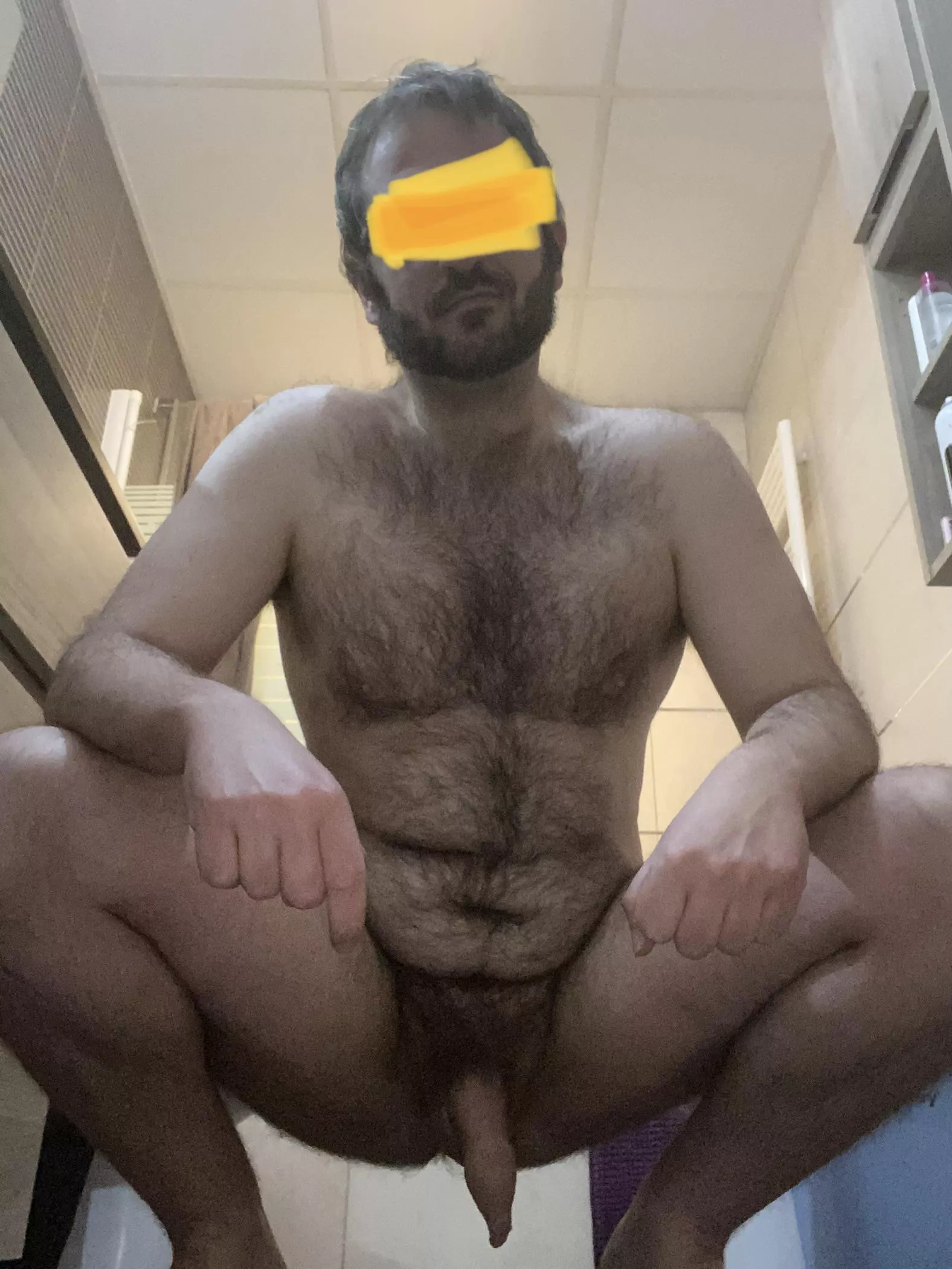 Fureskin is when you have fur and foreskin.