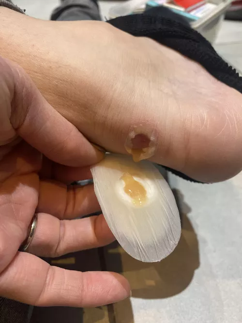 The forbidden egg yolk.