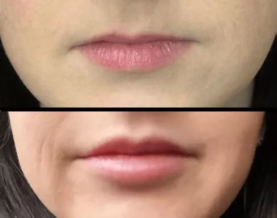 First lip upgrades on my wife. What do you think?