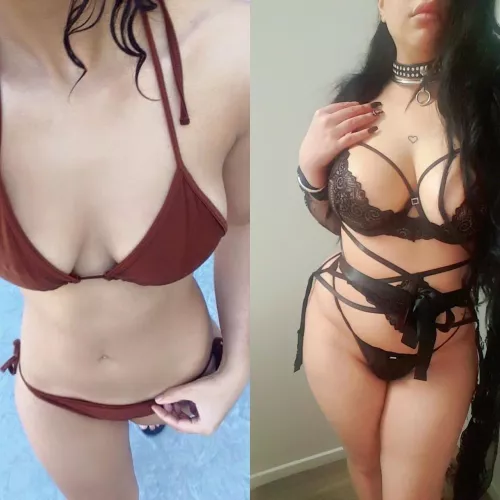 Anorexia vs now (no surgery yet)