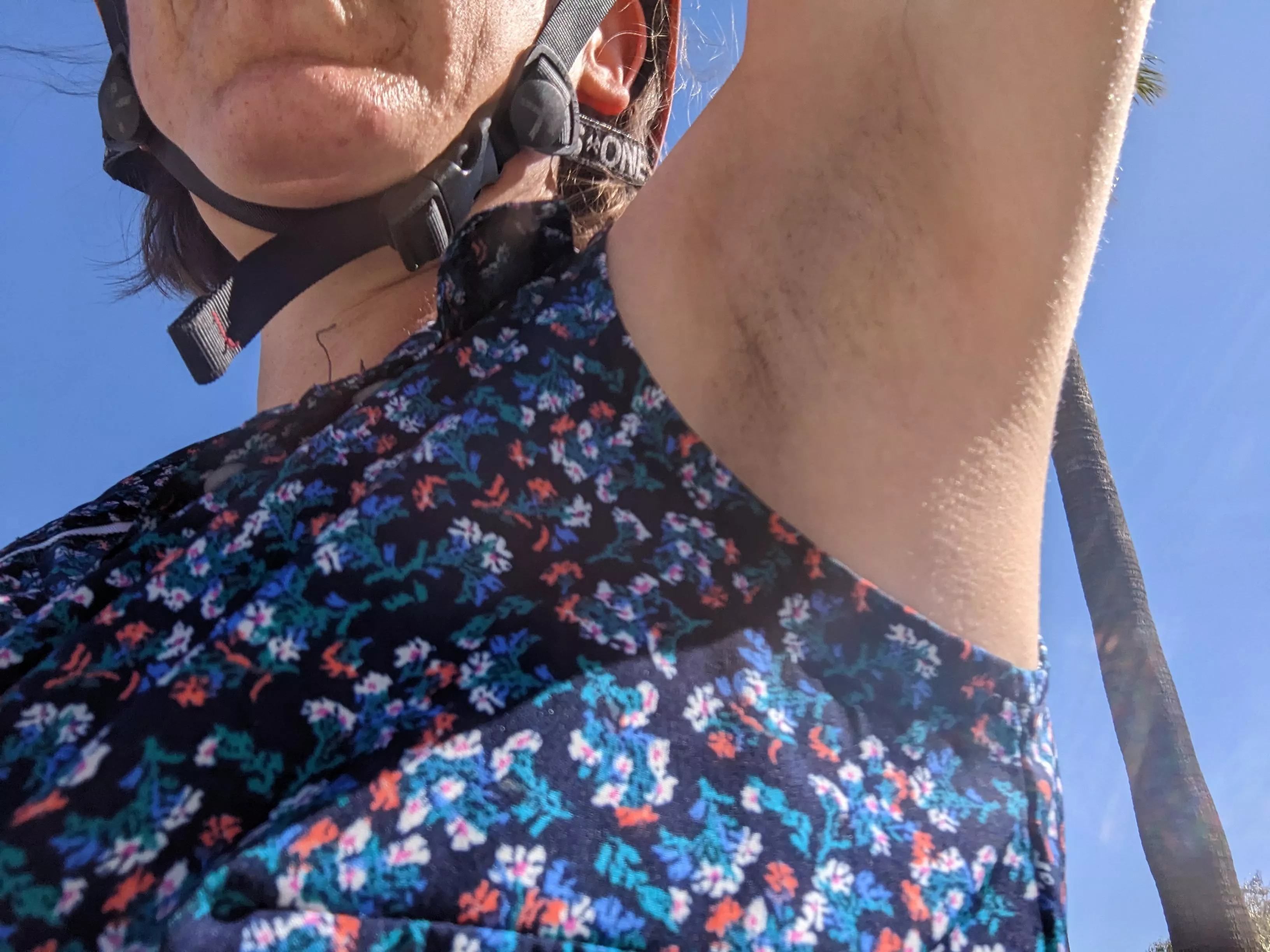 I took a picture of my armpit while I was roller skating