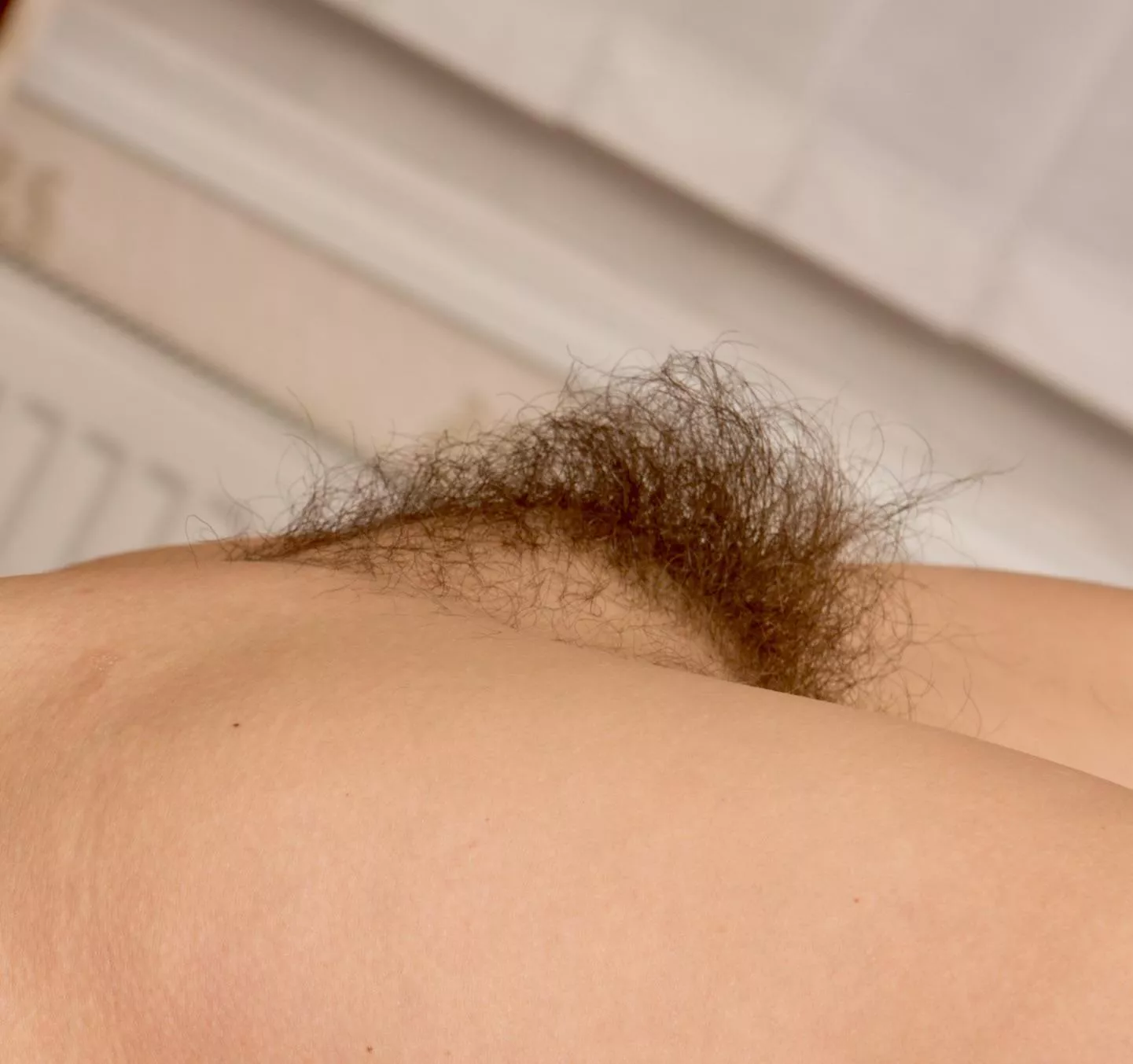 Shein’s hairy mound