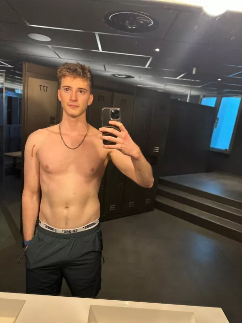 Sorry for the serious look, at least my scar is slowly fading