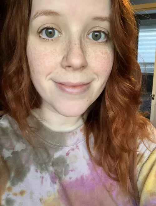 The sun is out which means so are the frecks! [F]