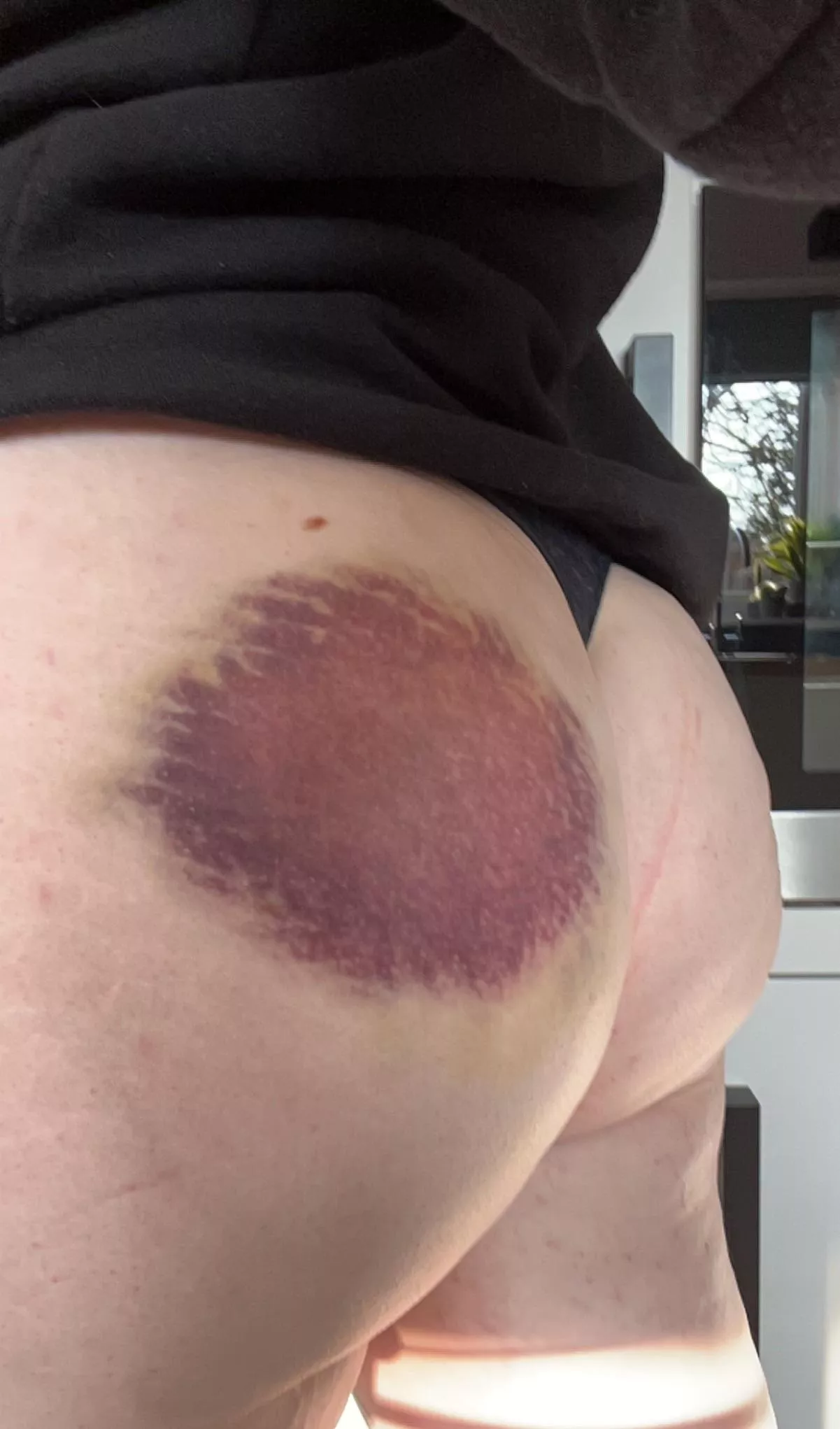 Aftermath of my most recent encounter [F]