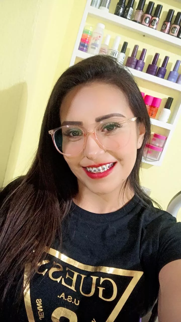 By any chance, do you like braces?🙇‍♀️