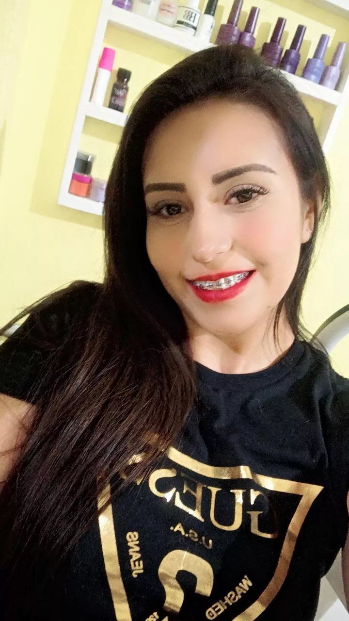 I hope you like braces papi 😚