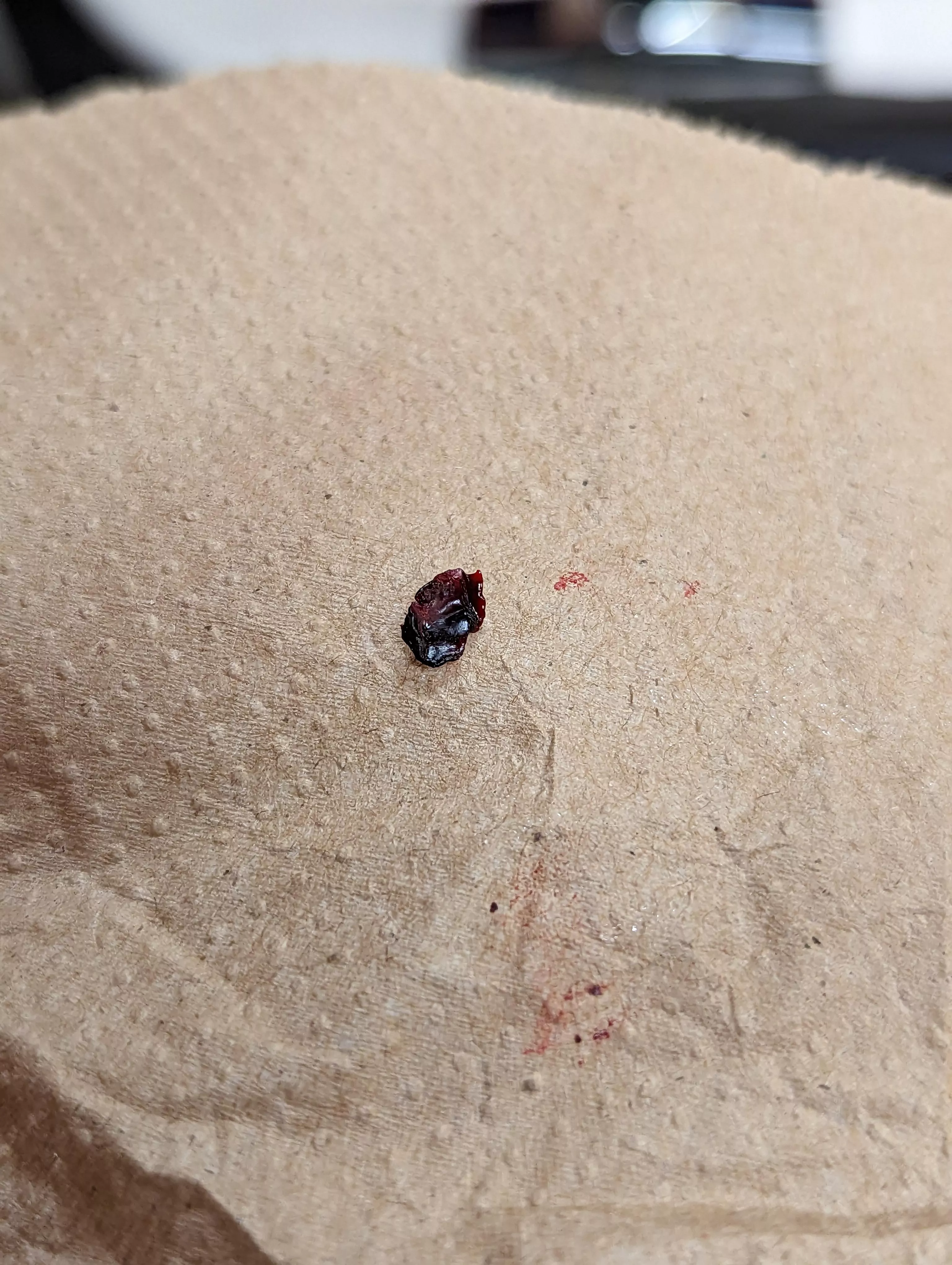 Inner ear scab. Forbidden craisin.