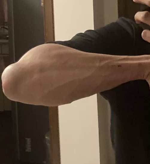 Forearm pump after a climbing session