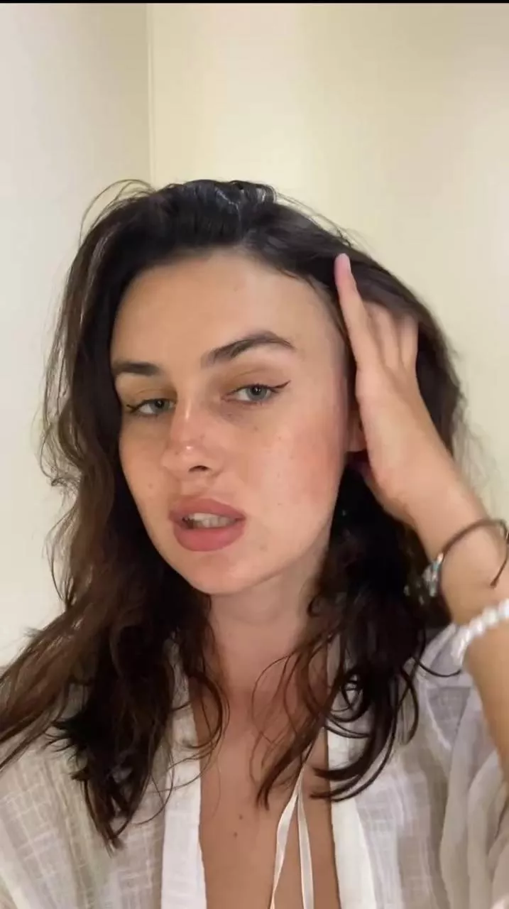 I hope my freckles don’t make me uglier 😅