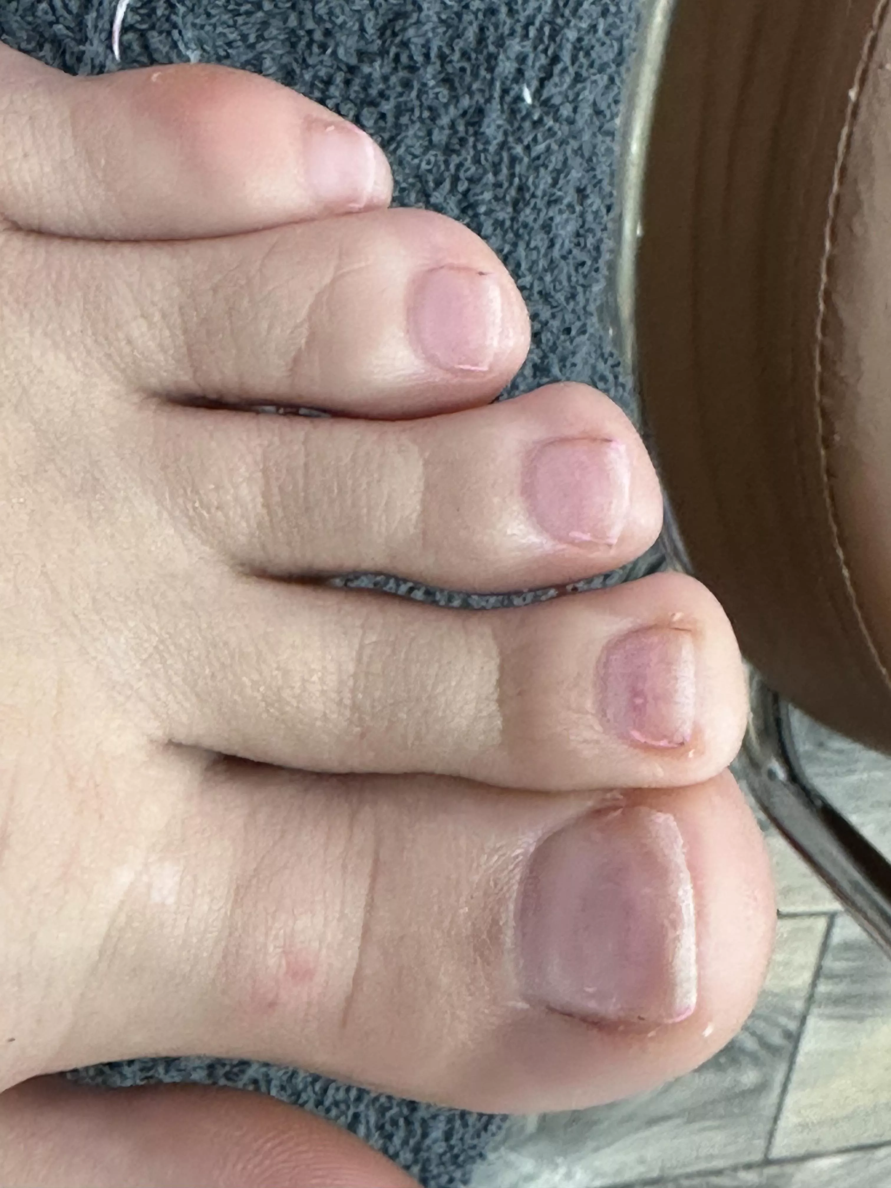 I rarely see them natural!