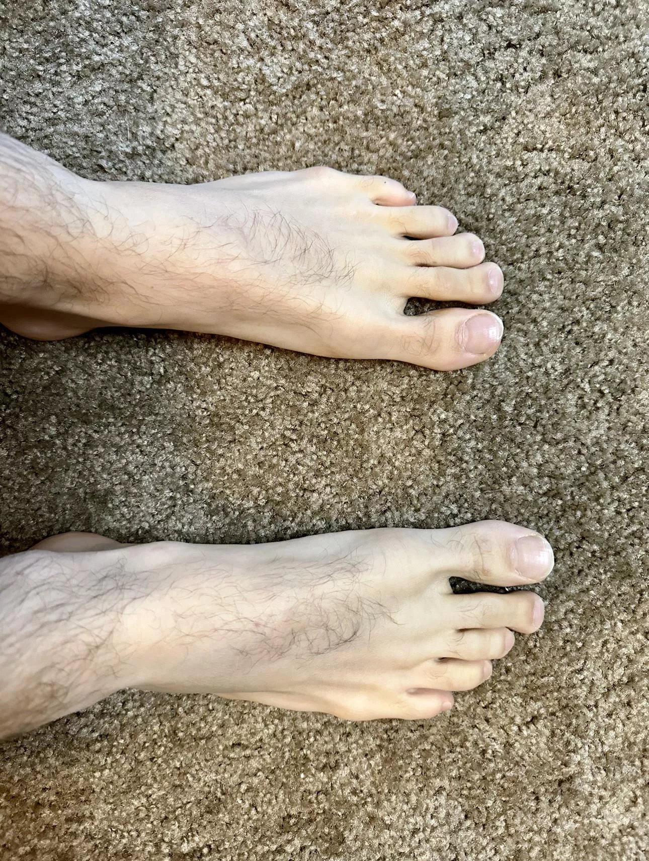 Is anyone into hairy feet? DMs are open if so!