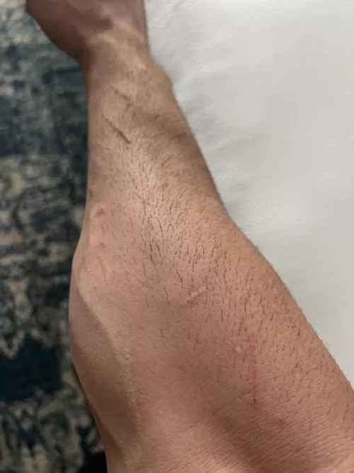 Mountain man forearms banged up from a day in the field 😮‍💨