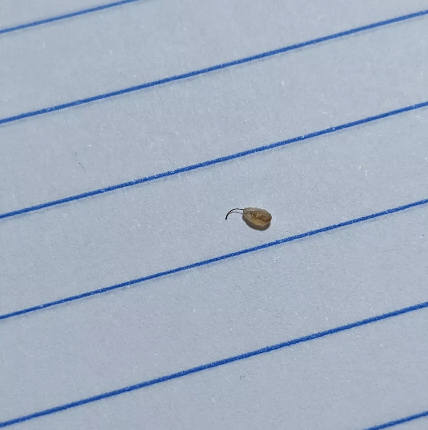 popped this out of my leg, no idea what they are but happens every few weeks.
