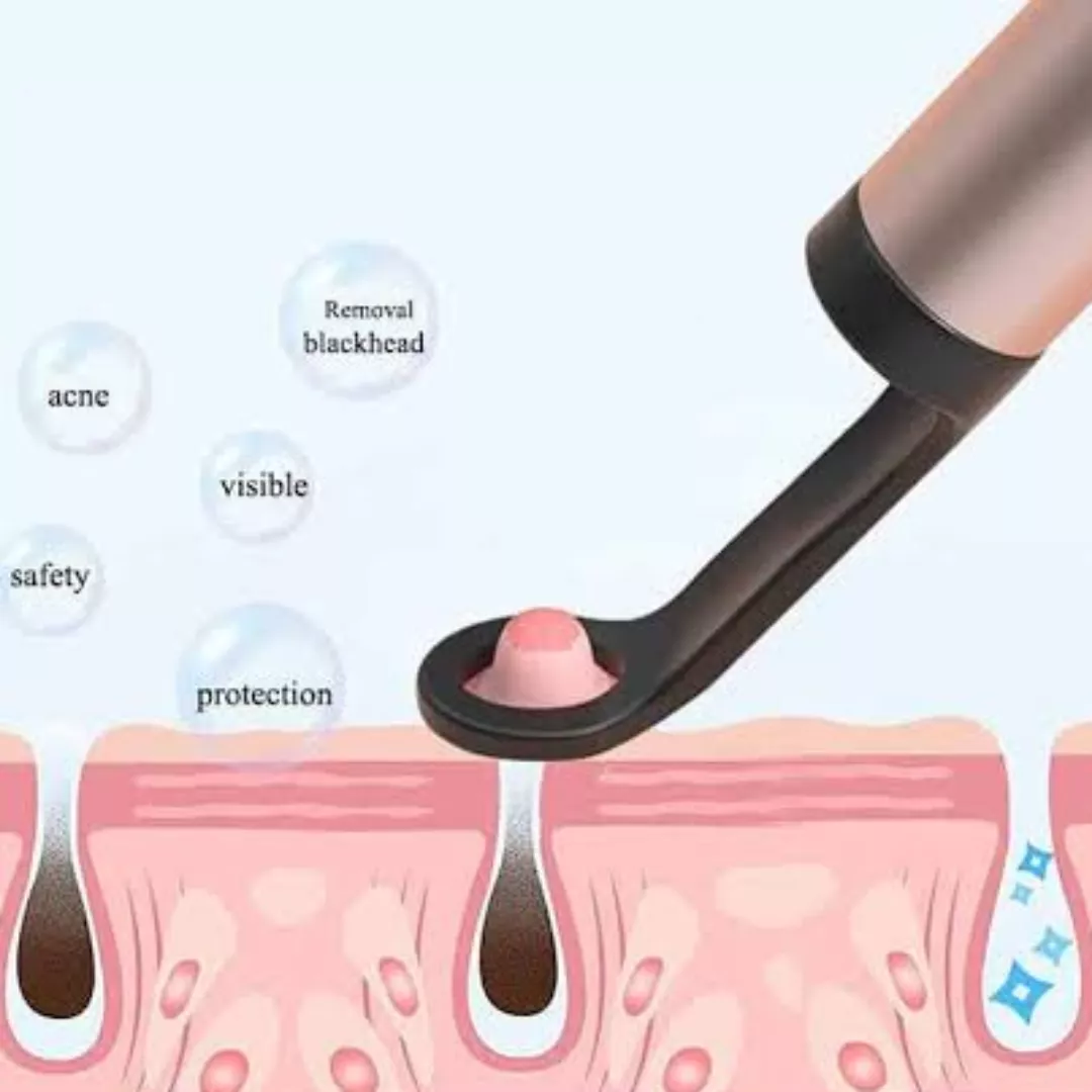 Community please give me your opinions, question in replies.