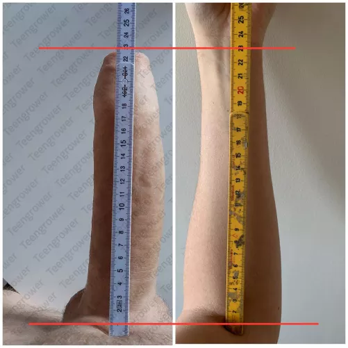 U/Teengrower vs. my forearm