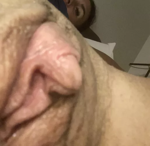 Needs every little attention