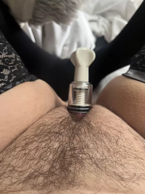 Finally growing back in after lasering it off a while back. Never again!