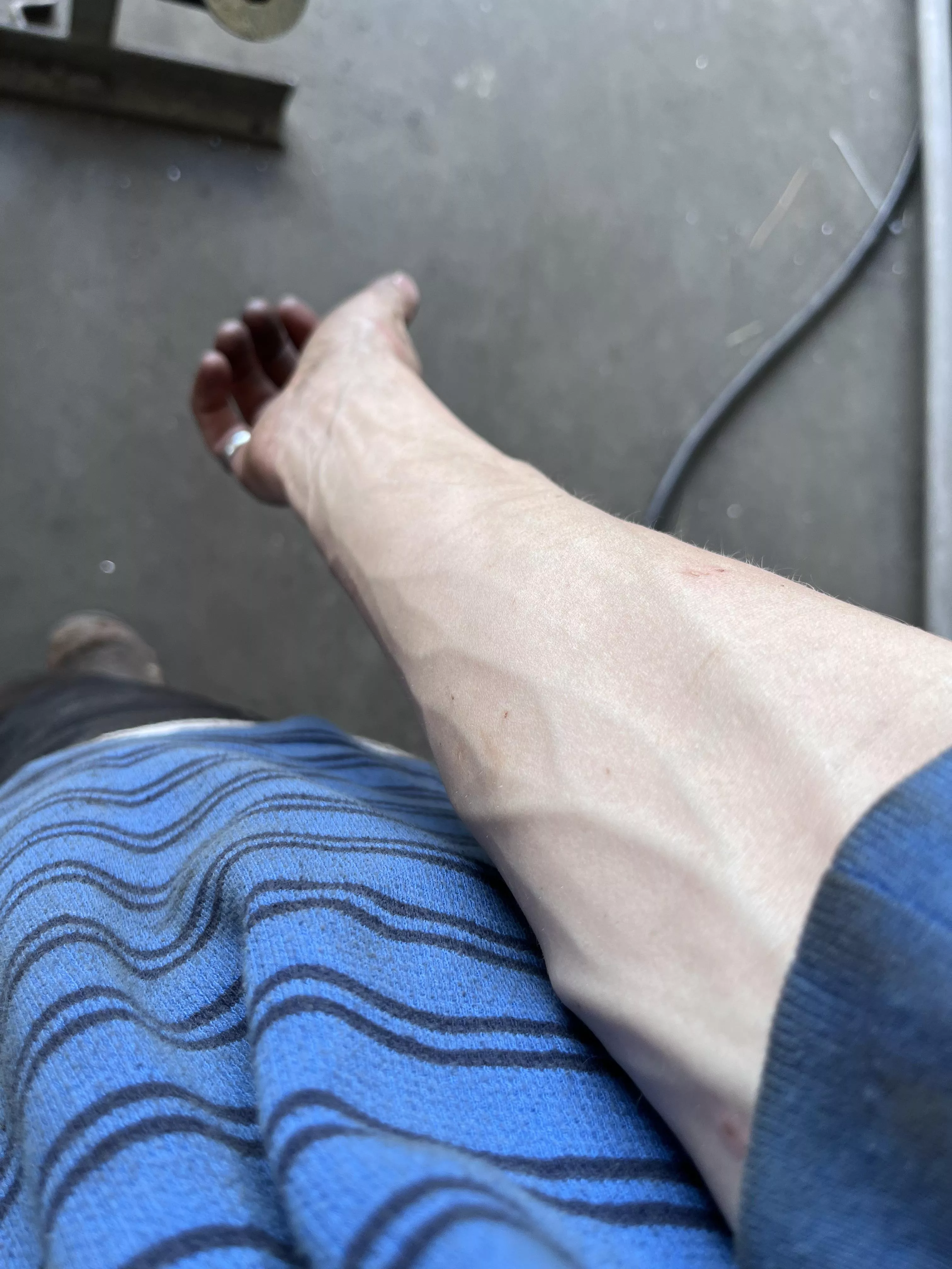 Small but vascular arms